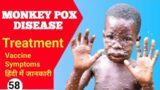 MONKEYPOX DISEASE !! SYMPTOMS !! DIAGNOSIS !! TREATMENT!! VACCINE !!