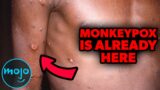Top 10 Things You Need to Know About MonkeyPox