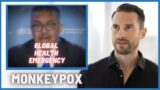Monkeypox Outbreak Global Health Emergency – Is Monkeypox the Next Pandemic?  – Doctor Mike Hansen