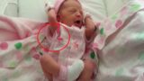 Newborn Baby Stretches – But When The Doctor Notices This Detail, He Says: "This Can't Be True"
