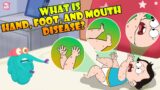 What Is Hand, Foot And Mouth Disease? | Infection In Children | The Dr Binocs Show | Peekaboo Kidz