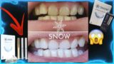 SEE THE TRUTH ABOUT SNOW TEETH WHITENING!SNOW TEETH WHITENING REVIWES DENTIST!/SNOW TEETH WHITENING.