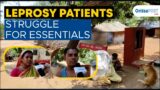 Leprosy patients struggle for essentials