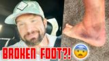 ACCIDENT IN THE MOUNTAIN | BROKEN FOOT | X-RAY REVEAL | BREAKING FOOT IN THE MOUNTAIN FAR FROM HOME