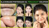Remove BLACKHEADS WHITEHEADS CLOGED PORES Naturally | Permanent Results | Get Smooth Glowing Skin |