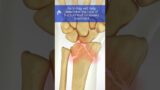 Understand Wrist Fractures – 3D Animation