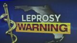 CDC issues warning in Florida due to rising cases of leprosy