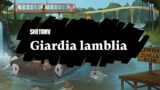 Giardia lamblia Lesson: Symptoms, diagnosis and treatment