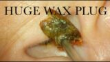HUGE WAX PLUG : COLACE TO THE RESCUE : 4K/HD