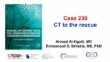 Case 239: Manual of CTO PCI – CT to the rescue
