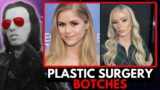 Razorfist on the Worst Plastic Surgery BOTCHES in Hollywood