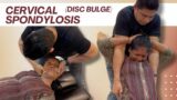 Severe Right-Side Body Pain from Cervical Spondylosis (Disc Bulge) treated by Dr Ravi #chiropractic