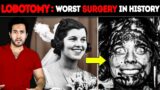 Why is LOBOTOMY The WORST Surgery in History