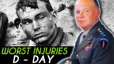 The WORST Wounds from the D-Day