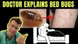 Doctor explains BED BUGS – including SYMPTOMS, TREATMENT AND PREVENTION ( +PHOTOS!)