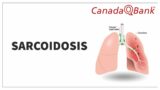 Sarcoidosis