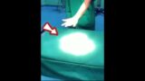 Surgical lights cast no visible shadow #wowvideo #lightmagic #rarevideo #rarecollection #omgvideo