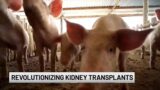 Pigs to the rescue: Revolutionizing kidney transplants