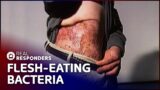 The Mysterious Flesh-Eating Disease That Kills In 3 Days | Diagnosis Unknown Marathon