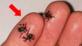 Man Thought He Had 'Bedbugs'. Expert Scream In Horror After Realizing What They Truly Are!
